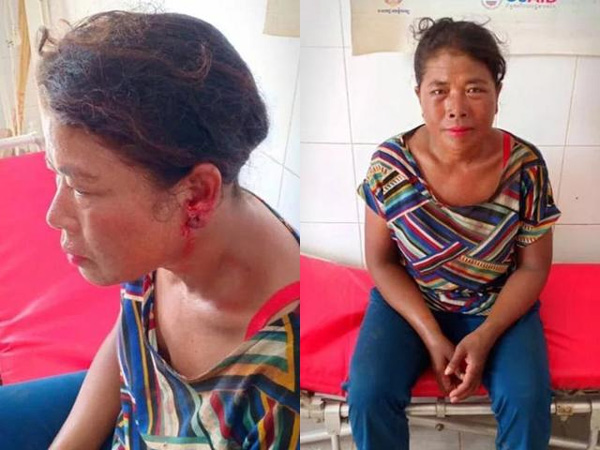 Không chịu xuống ăn sáng cùng vợ, chồng bị cắn đứt của quý kinh hoàng-2