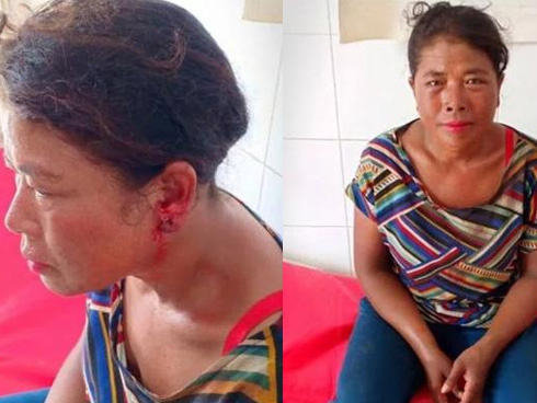 Người phụ nữ cắt của quý của chồng cũ và tuyên bố sốc-2