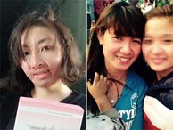 Cô gái Yên Bái bị chồng MC tẩm xăng đốt 3 năm trước giờ ra sao?