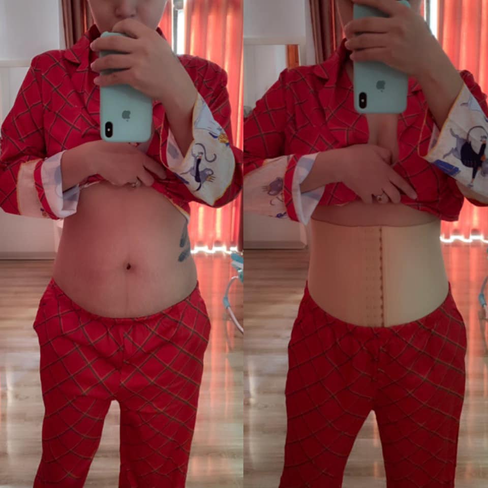 Hải Băng chia sẻ bí kíp lấy lại eo thon sau khi sinh con lần 3, bác sĩ kinh hãi vì phương pháp này có thể khiến mẹ bỉm sữa biến chứng nguy hiểm-3