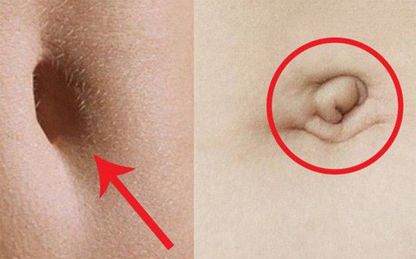 Ngó tướng rốn vài giây: Biết ngay phúc lộc chỉ nhờ vào điểm này, tương lai sướng khổ đều lộ rõ-2