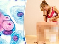 3 việc phụ nữ thường quen làm khiến tử cung bị bào mòn, viêm nhiễm nặng: Bỏ ngay trước khi quá muộn