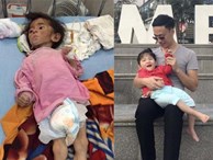 Hình ảnh mới nhất của em bé Lào Cai bị suy dinh dưỡng sau 3 năm về với mẹ nuôi khiến nhiều người ngạc nhiên