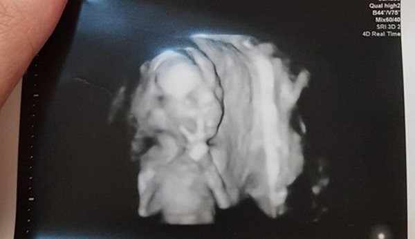 Chụp ảnh siêu âm mà giơ tay chào đủ kiểu, em bé từ trong bụng mẹ đã được dự đoán tương lai sau này vô cùng xán lạn-2