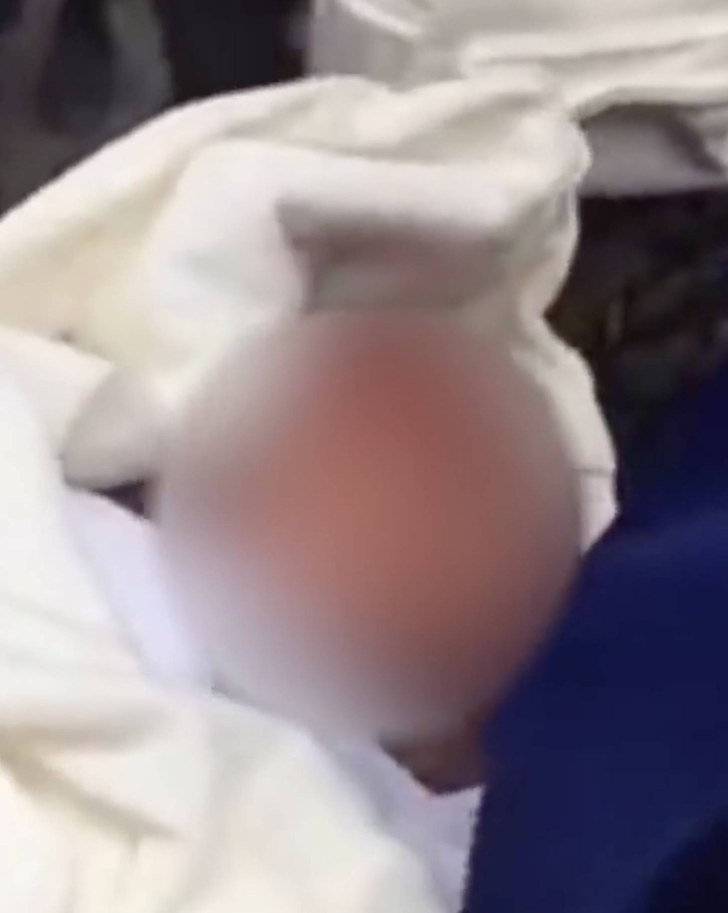 Mẹ đơn thân một mình sinh con rồi tự cắt dây rốn, sau đó ném xuống từ tầng 3 nhưng đứa trẻ đã sống sót một cách ngoạn mục-1