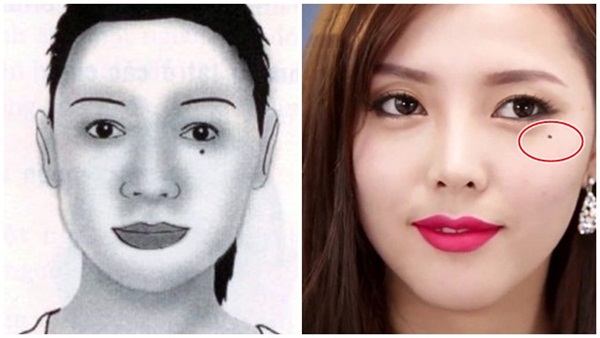 7 nốt ruồi độc mang đến toàn vận xui, giữ lại thì cả đời nghèo hèn, xoá bỏ sạch mới mong đổi vận-1