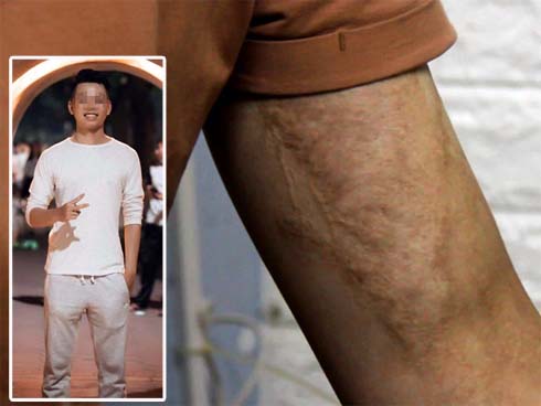 Vợ tới phòng Karaoke đánh ghen khi chồng công an hát cùng tiếp viên” khiến 2 người bị thương-4