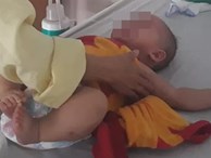 Bác sĩ tiếc nuối khi cắt buồng trứng bé 6 tháng tuổi chỉ vì sai lầm này của bố mẹ