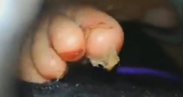 Bà mẹ quay video tra tấn tàn bạo 3 con nhỏ, nhẫn tâm rút móng chân của con chỉ vì muốn chứng minh tình yêu với bạn trai mới quen-2