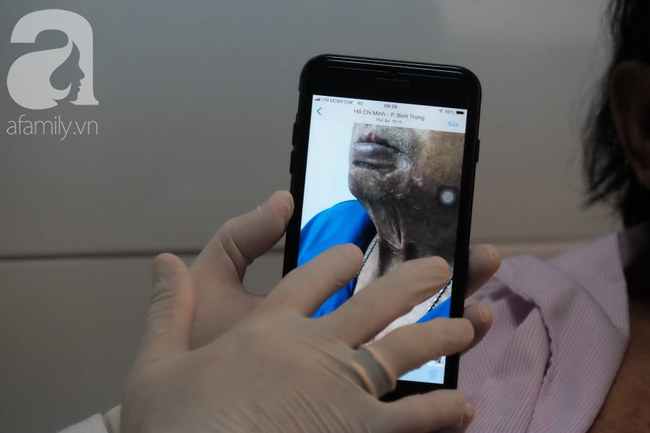 Nghi chồng có bồ nhí, người vợ hờ nổi cơn ghen dùng axit tạt khắp người gây bỏng nặng-3