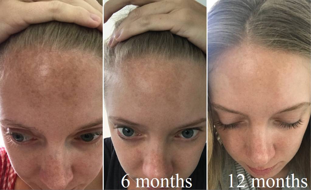 Cần chú ý: Kem chống nắng có thể khiến bạn lão hóa nhanh hơn nếu không có thêm thứ thần thánh” này-4