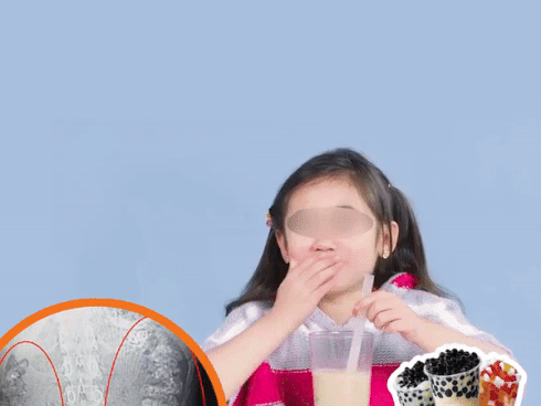 Nghiện trà sữa, bé gái bị hạt trân châu kẹt đầy bụng