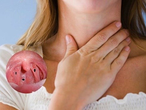 Dấu hiệu ung thư vòm họng chẳng mấy người để ý