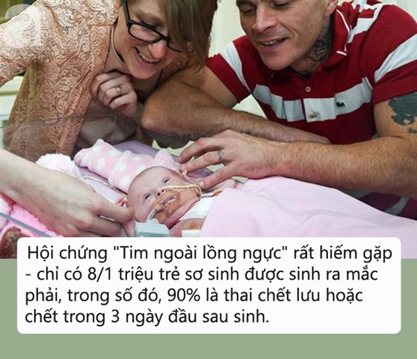 Bé gái mắc hội chứng tim ngoài lồng ngực chỉ có 10% sống sót, bố mẹ em quyết định làm việc này và điều kì diệu xảy ra-1