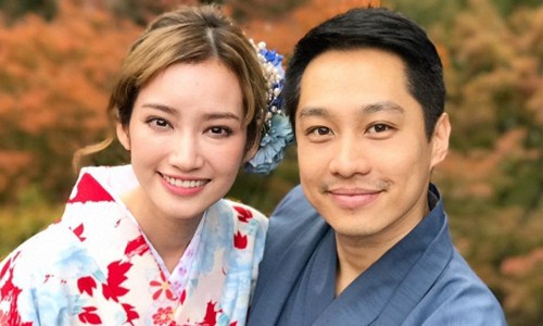 Hoa hậu Trúc Diễm: Mắt tôi đã bình thường rồi không lồi hay biến dạng nữa!-3