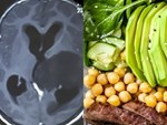 Nhầm lẫn giữa phương pháp ăn Keto và Low-carb khiến nhiều người không giảm được cân-2