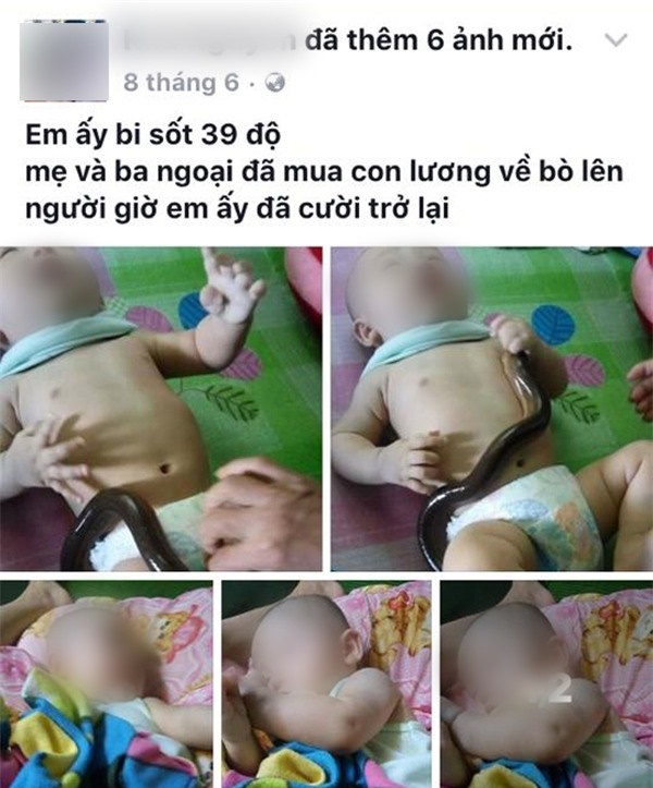 Hạ sốt bằng lươn tưởng hiệu quả ai ngờ con còn nhiễm bệnh nặng hơn: Mẹ thông thái chớ dại rước họa vào thân-1