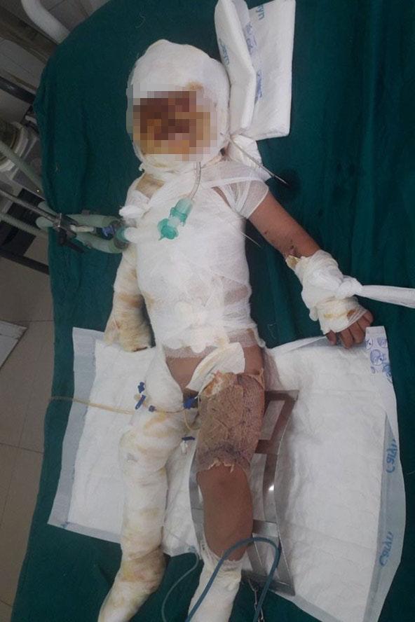 Mua xăng về nhà dùng chưa hết, mẹ Ninh Bình chết sững nhìn 2 con thành mồi lửa-1