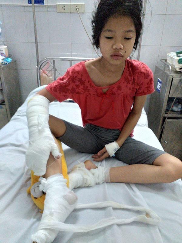 Mua xăng về nhà dùng chưa hết, mẹ Ninh Bình chết sững nhìn 2 con thành mồi lửa-2