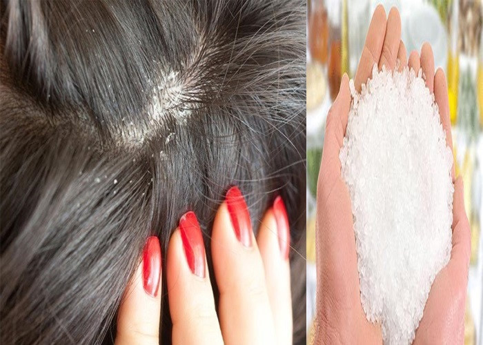 Đổ 1 muỗng này vào dầu gội, tóc óng mượt bồng bềnh, không còn bóng dáng của gàu lại thơm mát bất ngờ-2