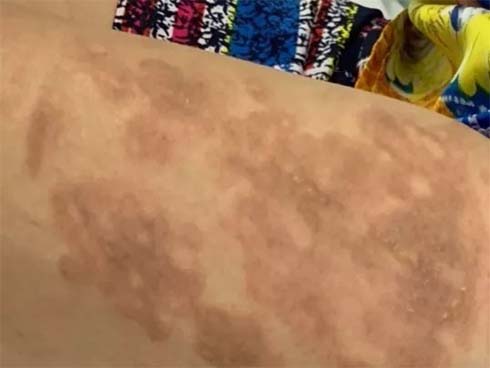 CLIP: Chủ quán cơm nói gì sau khi tạt chảo dầu sôi vào người hàng xóm?-2