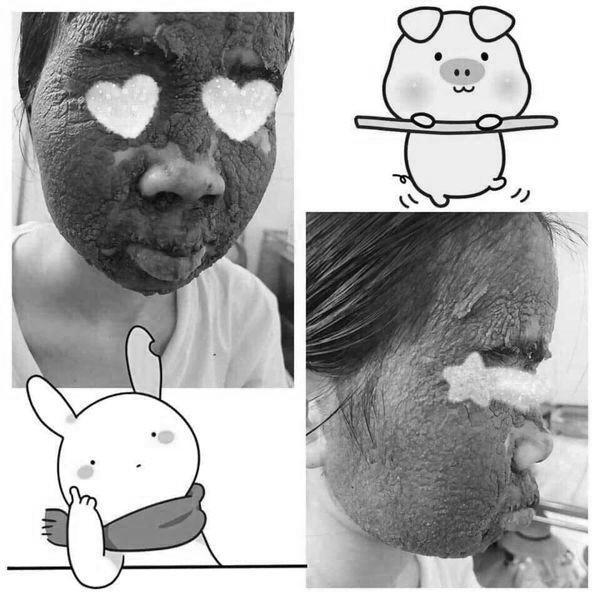 Nhầm tưởng lên đời nhan sắc nhờ rượu thuốc, cô gái khóc ròng vì làn da nham nhở, sần sùi-1