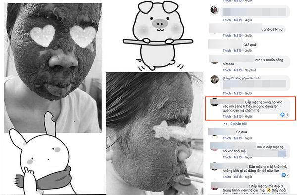 Nhầm tưởng lên đời nhan sắc nhờ rượu thuốc, cô gái khóc ròng vì làn da nham nhở, sần sùi-2