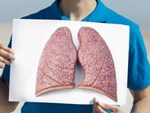 Người phụ nữ bị khàn giọng cứ ngỡ do nói to tiếng, nhưng không ngờ là mắc bệnh ung thư phổi-3