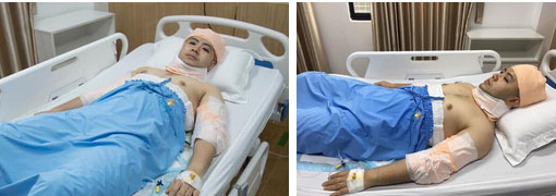 Thân hình phát tướng khó nhận ra, thần tượng 1 thời Akira Phan đi phẫu thuật hút mỡ, tạo cơ bụng?-3