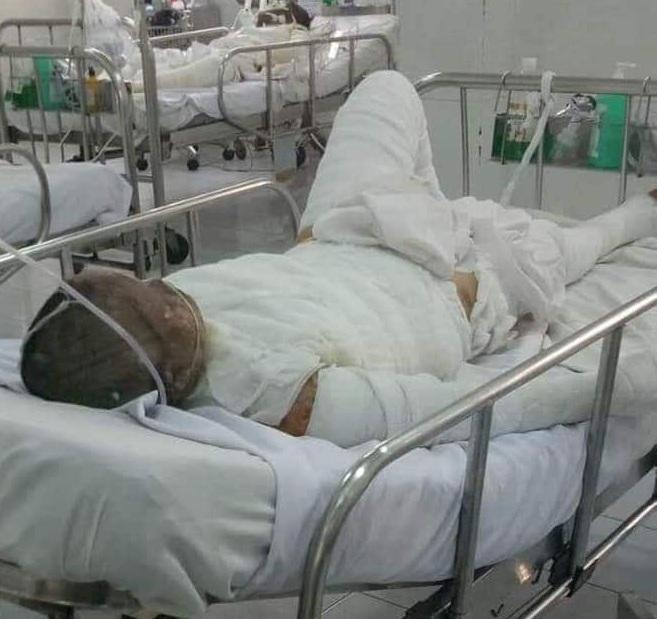 Bị chồng tẩm xăng thiêu sống, vợ xinh đẹp biến dạng mặt, con gặp lần đầu ngất lịm-2