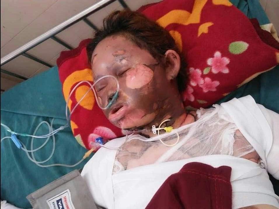 Bị chồng tẩm xăng thiêu sống, vợ xinh đẹp biến dạng mặt, con gặp lần đầu ngất lịm-3