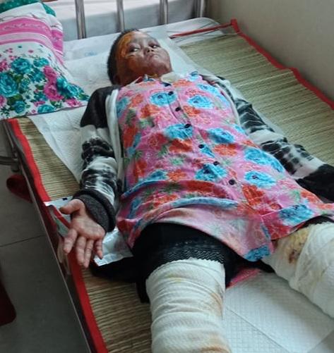 Bị chồng tẩm xăng thiêu sống, vợ xinh đẹp biến dạng mặt, con gặp lần đầu ngất lịm-4