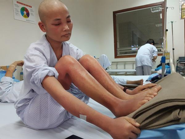 Mẹ ung thư người đỏ như tôm luộc, chỉ ước có đủ 1,4 triệu đồng để con không thất học-1