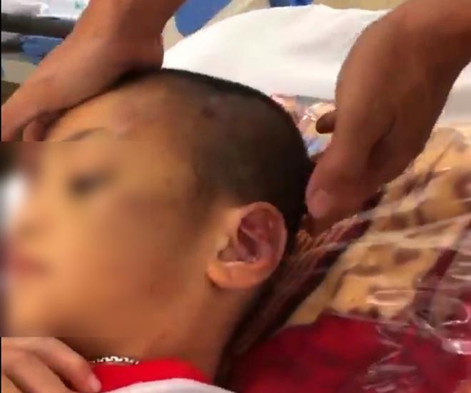 Vụ người phụ nữ và bạn tình đồng tính bạo hành con: Bé trai bị tra tấn hằng ngày bằng tay chân, cán chổi-4