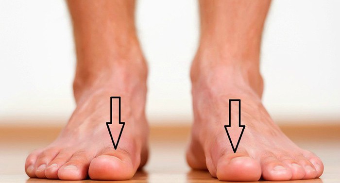 Dấu hiệu bất thường ở móng tay cảnh báo bệnh viêm van tim ít ai biết-3