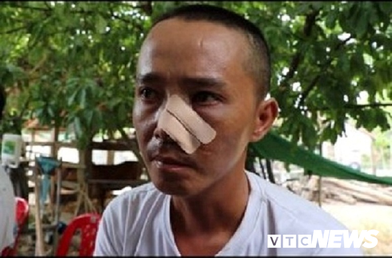 Ba cha con bị 20 người truy sát: Nạn nhân phẫn uất kể 3 trận đánh trong một buổi chiều-1