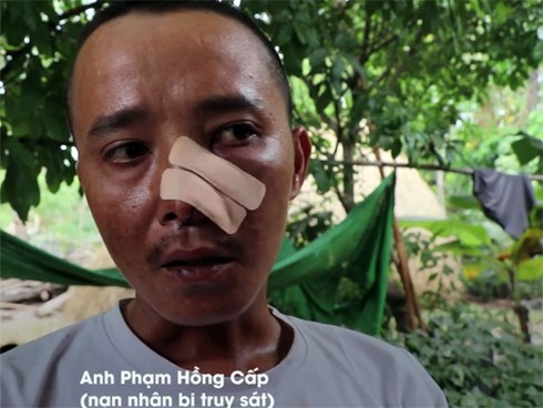 Ba cha con bị 20 người truy sát: Nạn nhân phẫn uất kể 3 trận đánh trong một buổi chiều
