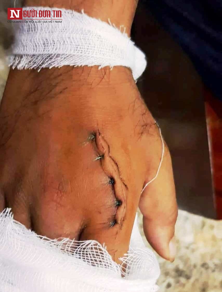 Vợ tới phòng Karaoke đánh ghen khi chồng công an hát cùng tiếp viên” khiến 2 người bị thương-3