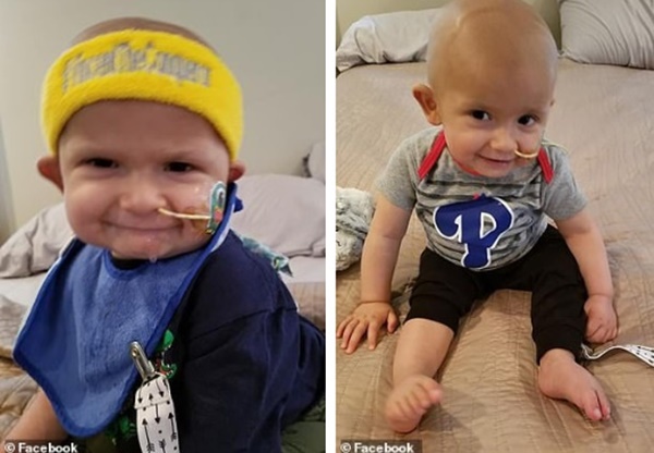 Thấy đầu con bắt đầu nghiêng nhẹ sang phải, bố mẹ không ngờ con trai 3 tháng tuổi bị bệnh ung thư nghiêm trọng đến thế-2