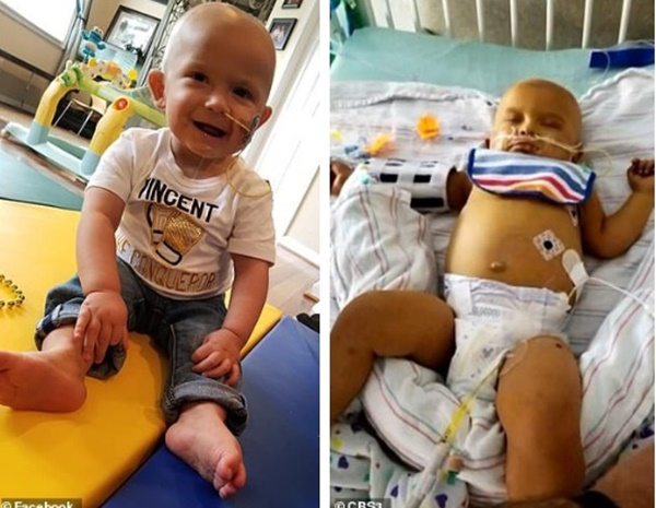 Thấy đầu con bắt đầu nghiêng nhẹ sang phải, bố mẹ không ngờ con trai 3 tháng tuổi bị bệnh ung thư nghiêm trọng đến thế-4