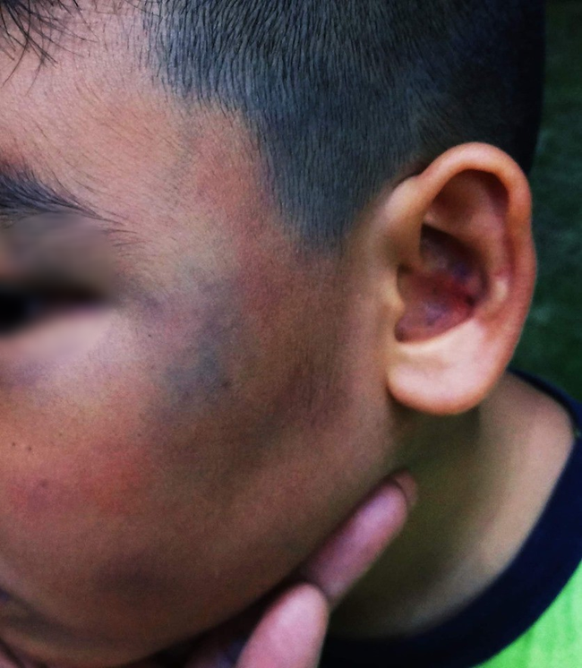 Xôn xao hình ảnh 1 bé trai bị hành hung dã man đến bầm tím mặt tại chung cư Sài Gòn-1