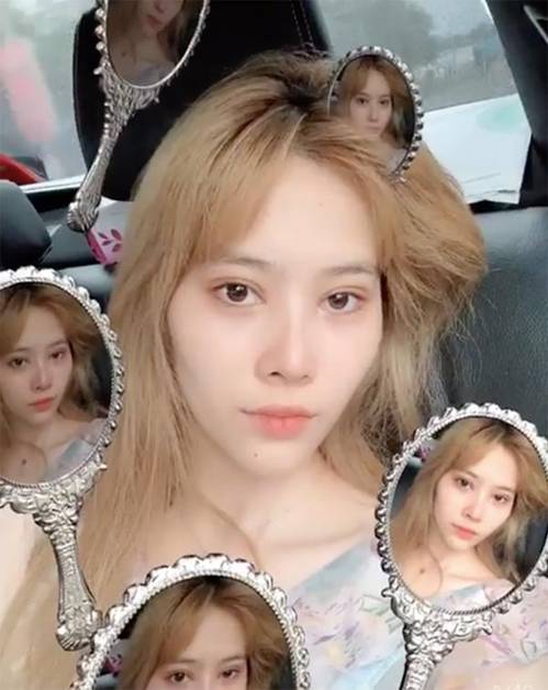 Sốc trước gương mặt xuống sắc trầm trọng, không thể nhận ra của Nam Em-3