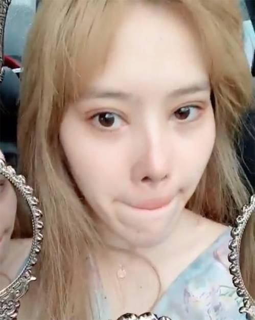 Sốc trước gương mặt xuống sắc trầm trọng, không thể nhận ra của Nam Em-4