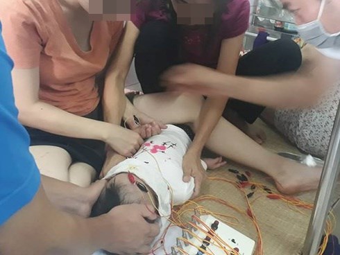 Bé gái 12 tháng liệt dây thần kinh ngoại biên do nằm điều hòa: BS khuyến cáo cách chăm sóc con an toàn