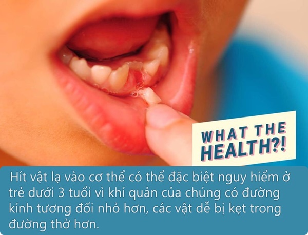 Sáng ngủ dậy thấy con mất 1 chiếc răng trong miệng, bố mẹ nhanh chóng đưa đến viện nên đã cứu được con-1