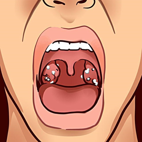 Miệng bốc mùi cảnh báo 9 vấn đề sức khỏe không hề đơn giản, cần khám gấp-1