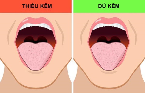 Miệng bốc mùi cảnh báo 9 vấn đề sức khỏe không hề đơn giản, cần khám gấp-3