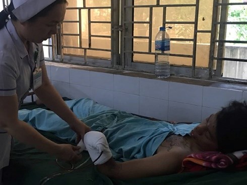 Dùng điện thoại khi sạc, nam thanh niên ở Đồng Nai bị nổ nát bàn tay