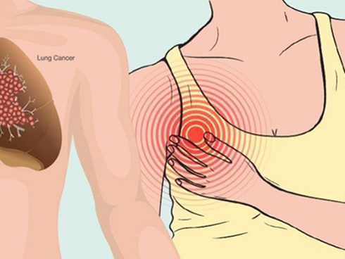 Mắc ung thư ở tuổi 31, bà mẹ một con đau đớn nhận ra: Tôi có 2 sai lầm triệu người đều mắc-3