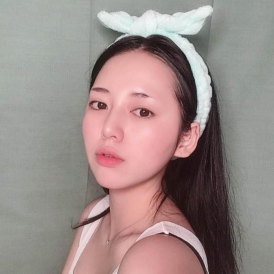 Được các bác sĩ da liễu ủng hộ hẳn hoi, đây là 5 công thức trị mụn bọc cây nhà lá vườn rẻ bèo nhưng lại cực hiệu quả-3